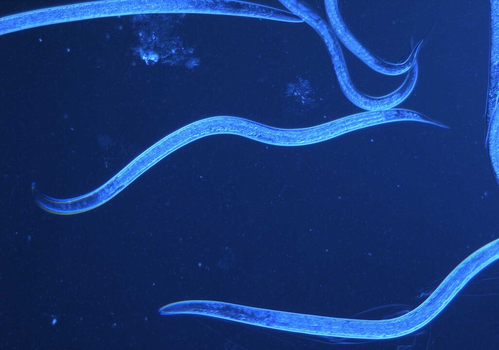emberi ostorféreg