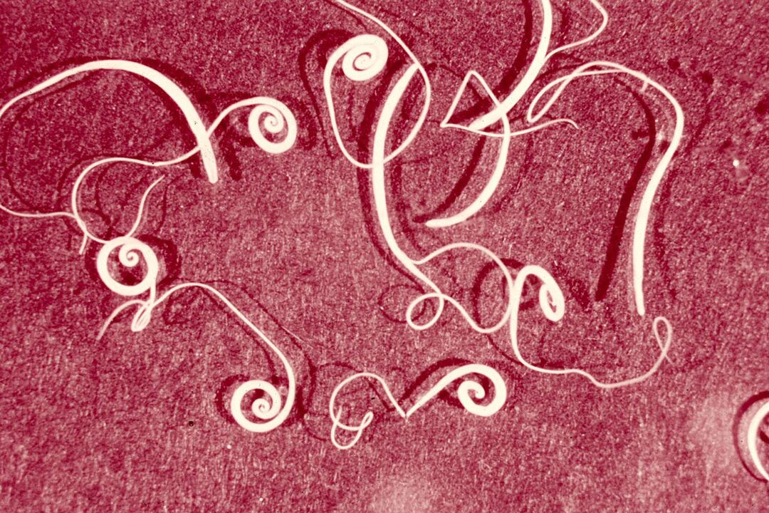 emberi trichinella férgek