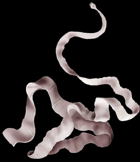 hogy néz ki a sertés galandféreg az emberi testben