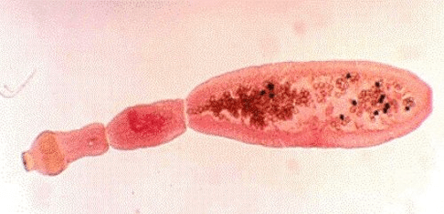 hogy néz ki az echinococcus az emberi testben