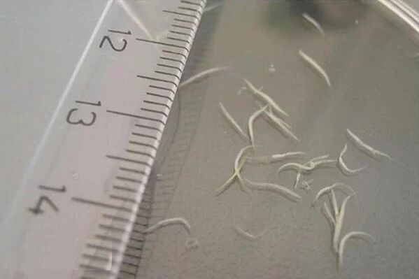 hogyan fordul elő pinworms mit kell tenni ha férgek jelennek meg