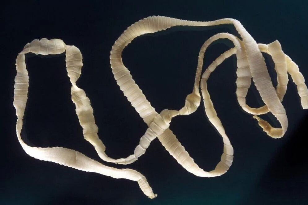 parazita férgek tünetei a testben pinworms élhet az epehólyagban